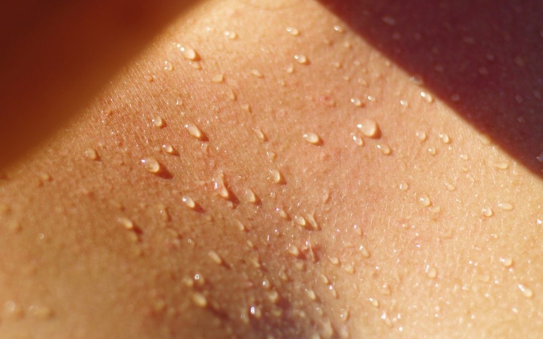 5 tips tegen uitslag van de warmte